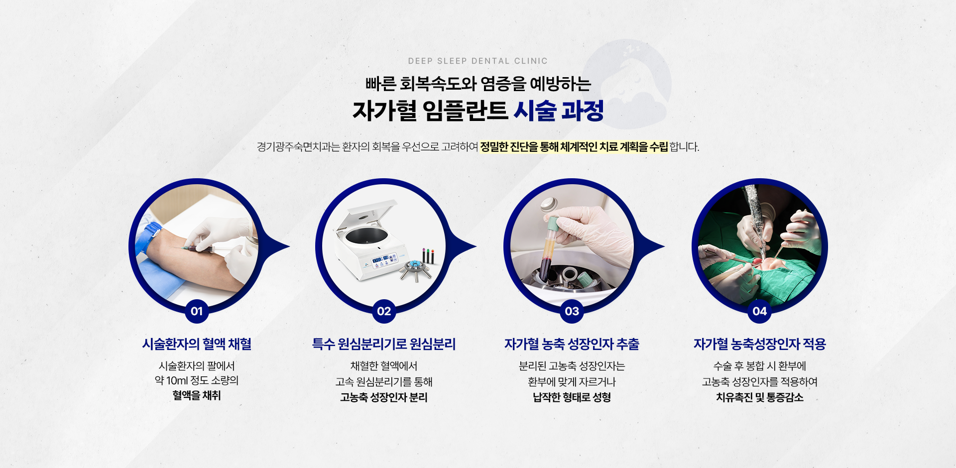 빠른 회복속도와 염증을 예방하는 자가혈 임플란트 시술 과정