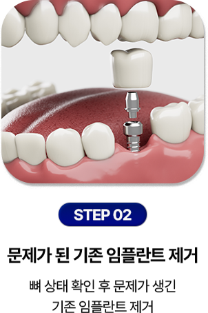 step 02