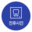 전후사진