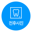 전후사진