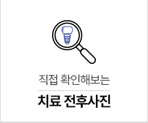 치료 전후사진